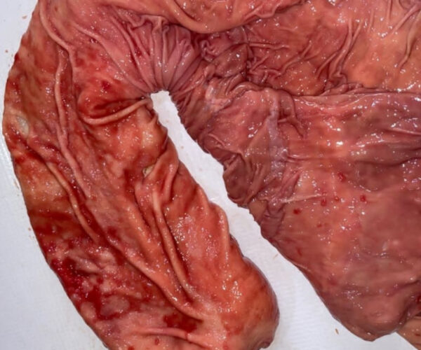 78a63a9e9bc98bcc60311bbbb77740955c996c4e